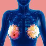 Descubren científicos de la UNAM gen del cáncer de mama