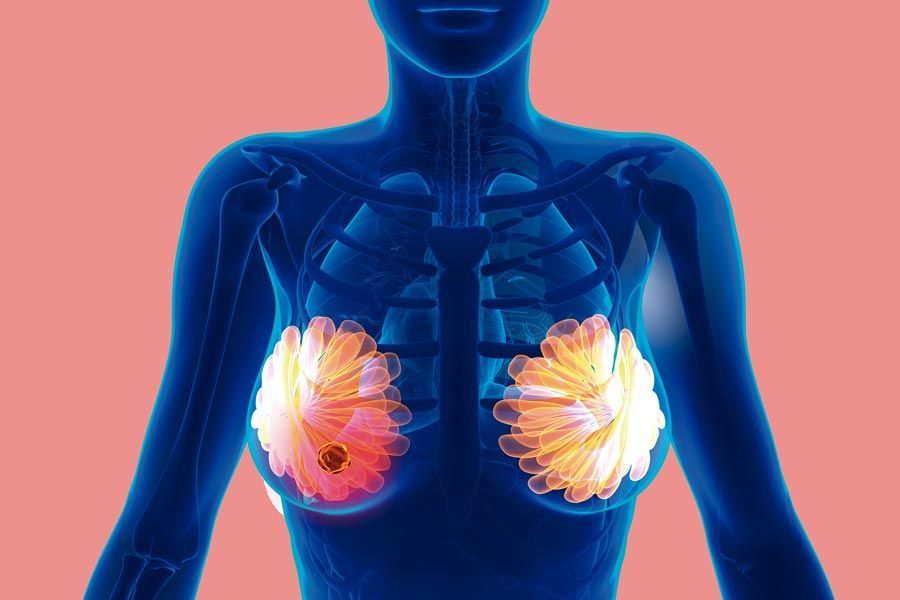 Descubren científicos de la UNAM gen del cáncer de mama