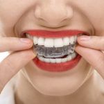 ¿Eres de ellos? Rechinan los dientes 80 por ciento de los mexicanos