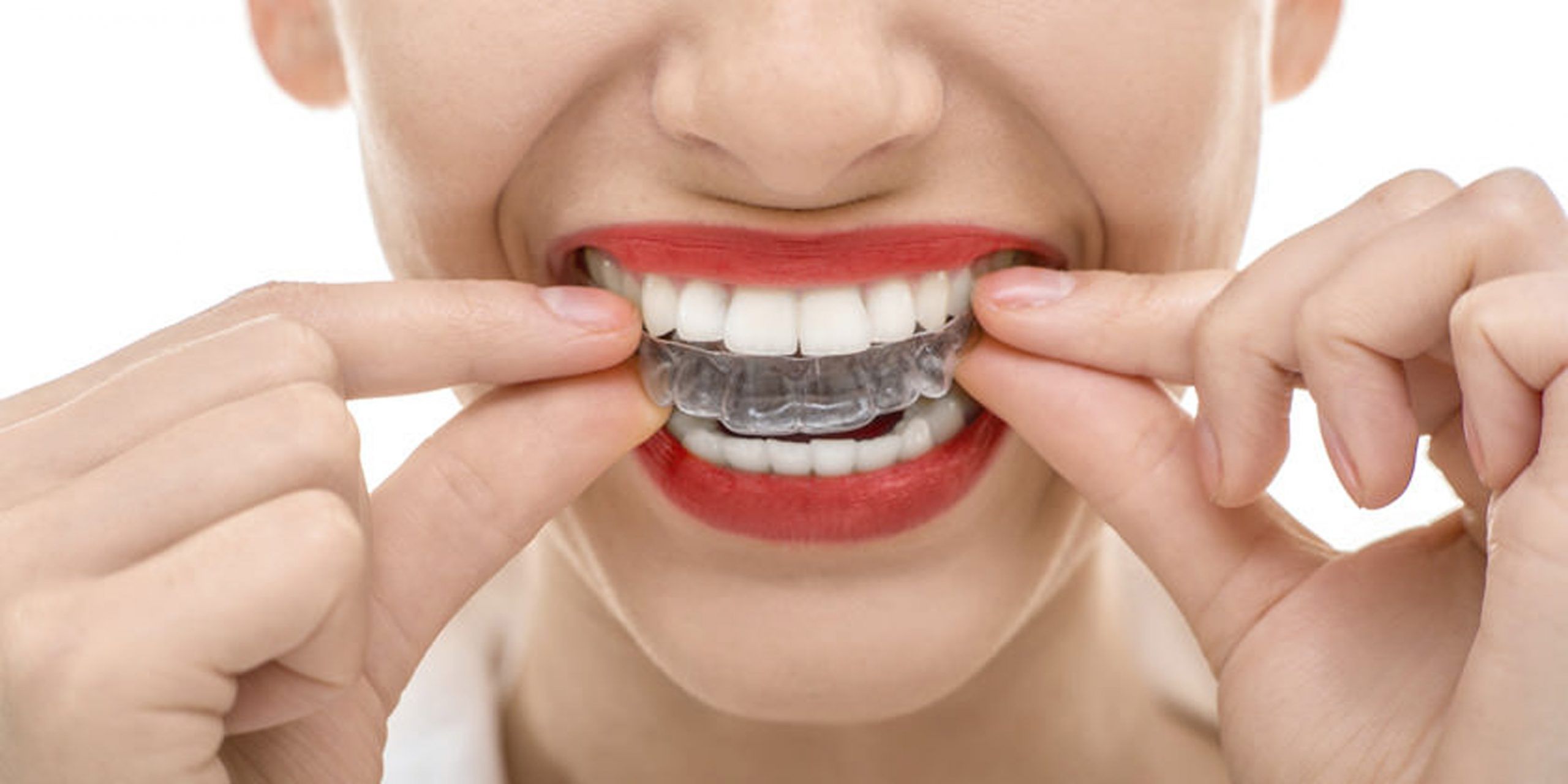 ¿Eres de ellos? Rechinan los dientes 80 por ciento de los mexicanos