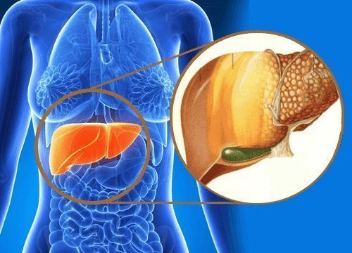 ¿Qué es el hígado graso y cómo prevenirlo?