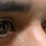 Conjuntivitis, un nuevo síntoma de Covid-19