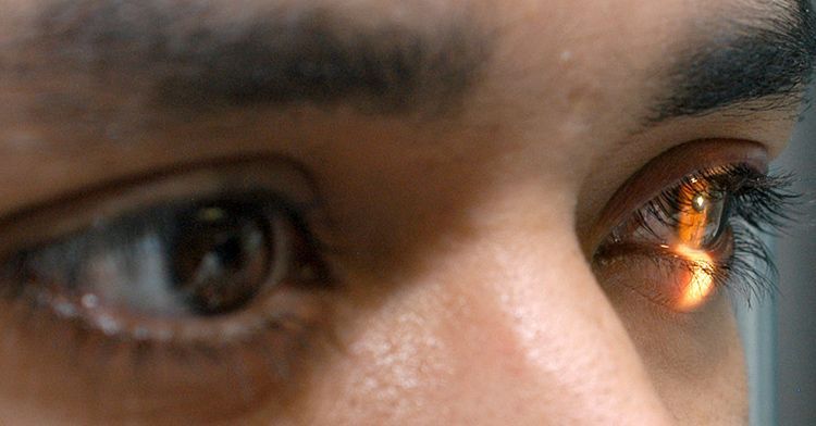 Conjuntivitis, un nuevo síntoma de Covid-19
