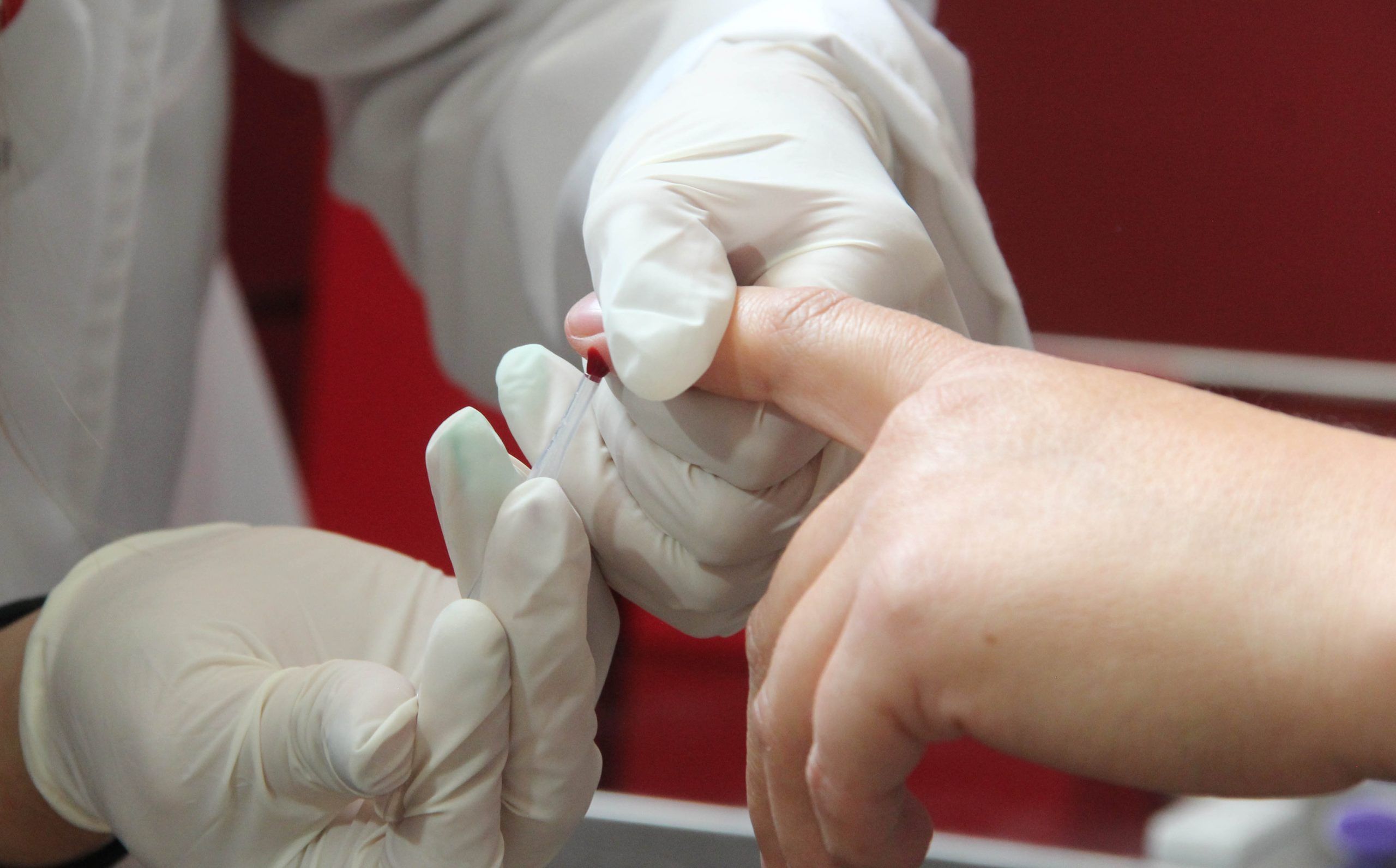 En el Hidalgo, la Secretaría de Salud estatal (SSH) exhorta a la población para que acuda a los Centros Ambulatorios para la Prevención y Atención del Síndrome de Inmunodeficiencia Adquirida (SIDA), de Infecciones de Transmisión Sexual (CAPASITS) y a los Servicios de Atención Integral Hospitalaria (SAIH). La prevención, el diagnóstico oportuno y atención, así como la eficacia de los tratamientos, ha permitido una respuesta integral centrada en los derechos de todas las personas conforme indica la directriz marcada por el Programa Sectorial de Salud, derivado del Plan Nacional de Desarrollo 2019-202. El tratamiento denominado PREP (profilaxis previa a la exposición), es un medicamento que se prescribe a las personas que si bien, aún no tienen VIH, están en un mayor riesgo de contraerlo. Si se toma anticipadamente, reduce en más de 90% el riesgo de contraer la infección por el VIH. En el primer trimestre del 2024, el sector salud hidalguense brindó 45 tratamientos para usuarios, de los cuales, a 34 pacientes se les otorgó por ingesta diaria y 11 de ellos, en la modalidad de ingesta por evento. La PREP está considerada para personas en condiciones que pudieran exponerles al VIH y que no cuentan con los recursos necesarios para tener una atención médica adecuada. Cabe mencionar que las personas que pueden adquirir las enfermedades de transmisión sexual son las que tienen una vida activa sin uso de preservativos, así como parejas que tienen VIH, pero no reciben tratamiento viral y los que tienen problemas de drogadicción y comparten jeringas, entre otros. Mientras que la profilaxis posterior a la exposición o profilaxis post exposición (PEP, por su sigla en inglés), es la utilización a corto plazo de los antirretrovirales (ARV) con el fin de reducir la probabilidad de contraer el VIH después de una posible exposición, ya sea de tipo ocupacional (accidentes en el trabajo) o no ocupacional, (por violación o el uso de materiales de inyección contaminados). Es por ello, que la atención del VIH y Sida sigue siendo uno de los mayores retos para la salud pública en el mundo. Desde sus inicios, ha cobrado la vida de más de 33 millones de personas.
