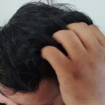 Por calor, SSH pide prevenir contagios por piojos en infancias     
