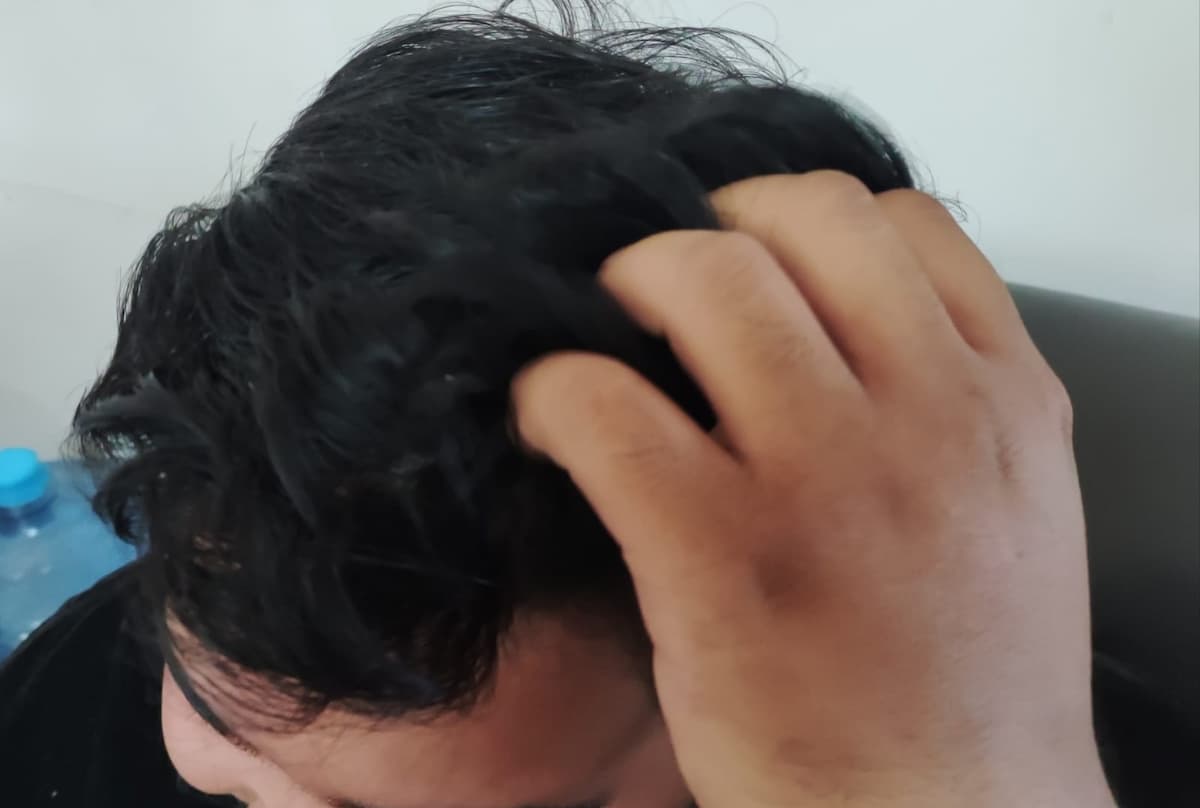 Por calor, SSH pide prevenir contagios por piojos en infancias     
